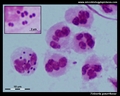 neisseria gonorrhoeae